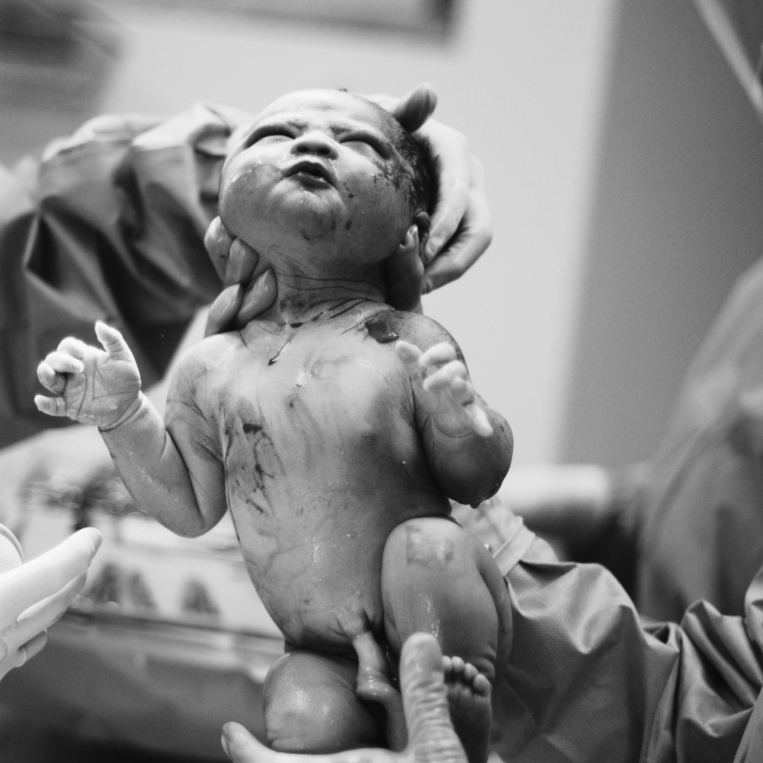 Photo of Preparing for a planned caesarean – online